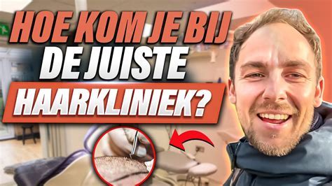 Hoe Kies Je De Juiste Kliniek Voor Haartransplantatie?